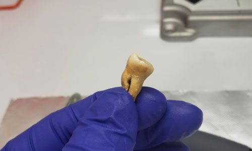 Giordania. A Jerash identificato il batterio della Peste di Giustiniano, la più antica pandemia della storia