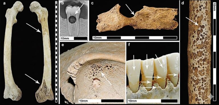 Urbanizzazione romana: la salute peggiorò solo nelle città